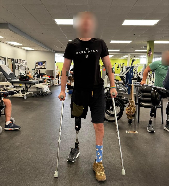 A Ukrainian soldier undergoes therapy in Chicago. Patients' faces have been blurred. (Courtesy Oleksandra Soltinska)